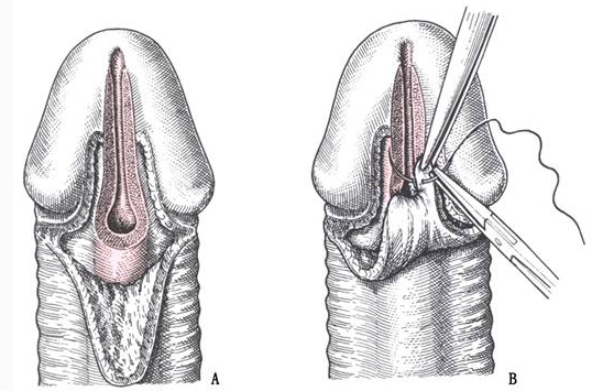 1492076870239428.png blob.png