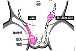 1481954538513024.png blob.png