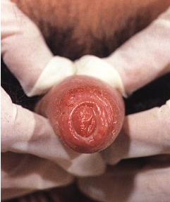 1481965416849877.png blob.png