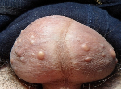 1491983667524385.png blob.png