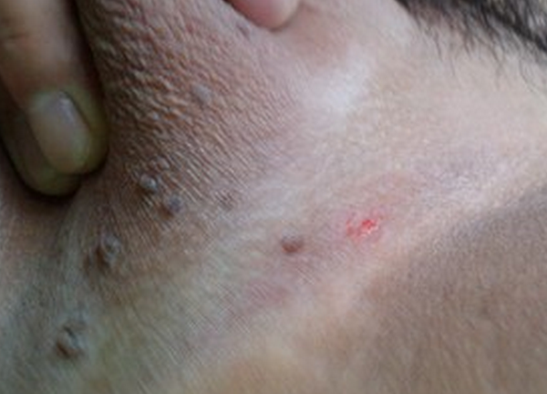 1491983712609071.png blob.png